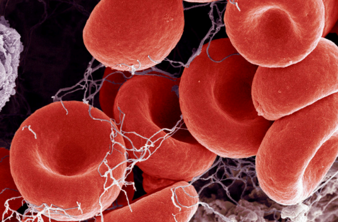 “ZERO CALORIE SWEETNER LINKED TO HEART ATTACK AND STROKE (Erythritol)…CNN”