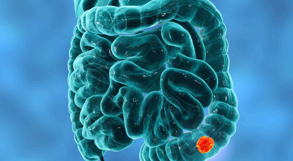 Small Intestine Microbiome Considerations and Sporebiotics